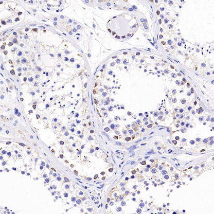 TFAM Recombinant Rabbit mAb (S-1018-53)