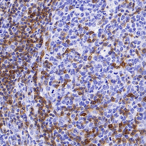 CD5 Recombinant Rabbit mAb (SDT-2570-53)