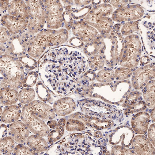 RPL26L1 Recombinant Rabbit mAb (S-R317)