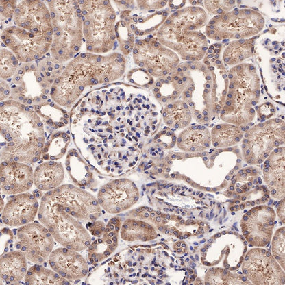 RPL26L1 Recombinant Rabbit mAb (S-R317)
