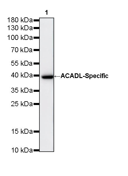 ACADL-Specific Recombinant Rabbit mAb