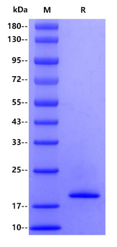 Mouse IL-1 beta/IL-1F2 protein, His tag