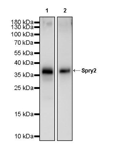 Spry2 Recombinant Rabbit mAb (S-3314-25)