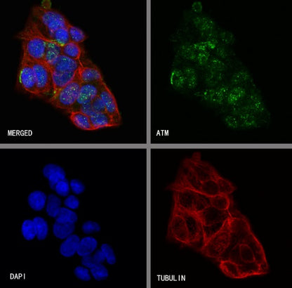 ATM Recombinant Rabbit mAb (S-2178-4)