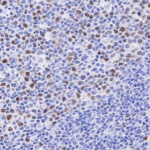 Geminin Recombinant Rabbit mAb (S-427-204)