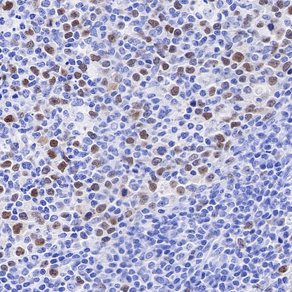 Geminin Recombinant Rabbit mAb (S-427-204)
