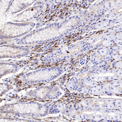 Human IgA1 Rabbit Polyclonal Antibody