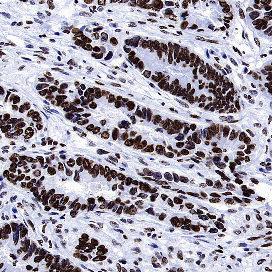 Histone H3 (tri methyl K27) Recombinant Rabbit mAb (S-4331)