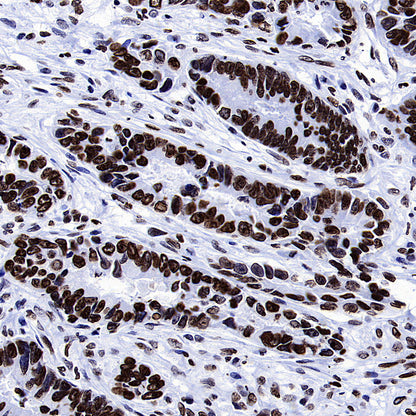 Histone H3 (tri methyl K27) Recombinant Rabbit mAb (S-4331)