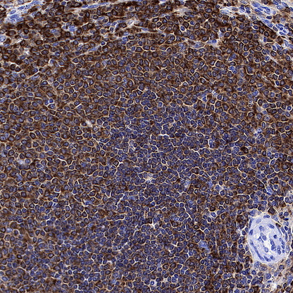 PTPN6 Rabbit Polyclonal Antibody