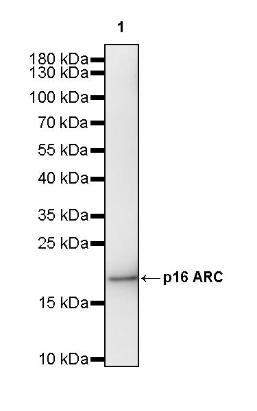 ARPC5/p16 ARC Recombinant Rabbit mAb (S-3564-23)