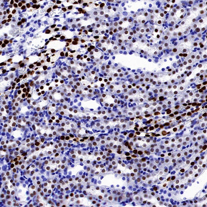 FOXC1 Recombinant Rabbit mAb (S-1607-142)