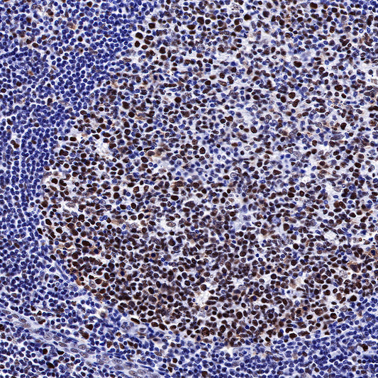 MSH2 Recombinant Rabbit mAb (SDT-037-20)