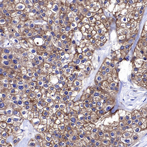Atg5 Recombinant Rabbit mAb (S-3181)