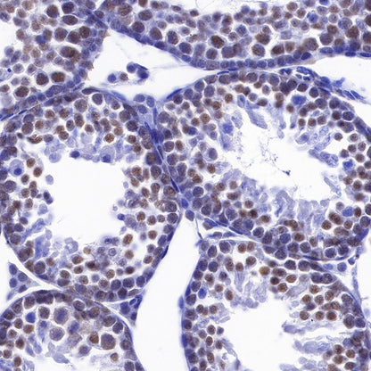 RNA polymerase II CTD repeat YSPTSPS (phosphor S2) Recombinant Rat mAb (S-R199)