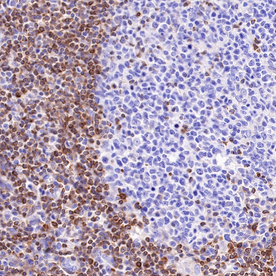 S-RMab® Bcl-2 Recombinant Rabbit mAb,PBS Only (SDT-R160)