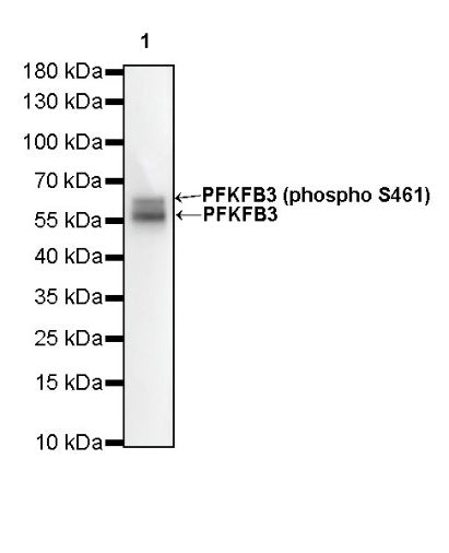 PFKFB3 Recombinant Rabbit mAb (S-653-35)