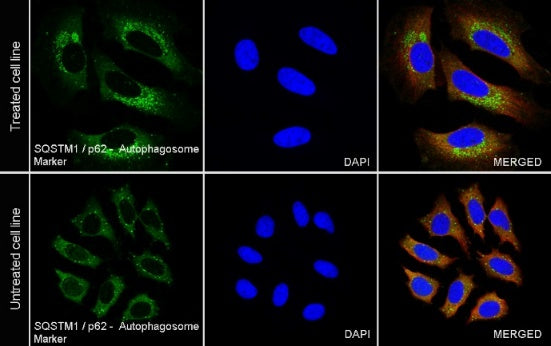 SQSTM1/p62 Recombinant Rabbit mAb (S-778-1)