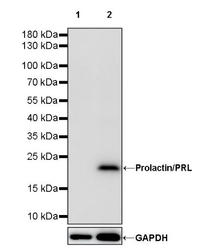 Prolactin/PRL Recombinant Rabbit mAb (S-235-215)