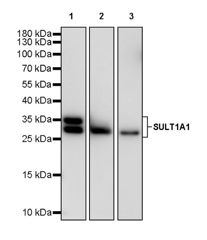 SULT1A1 Recombinant Rabbit mAb (S-4125-51)