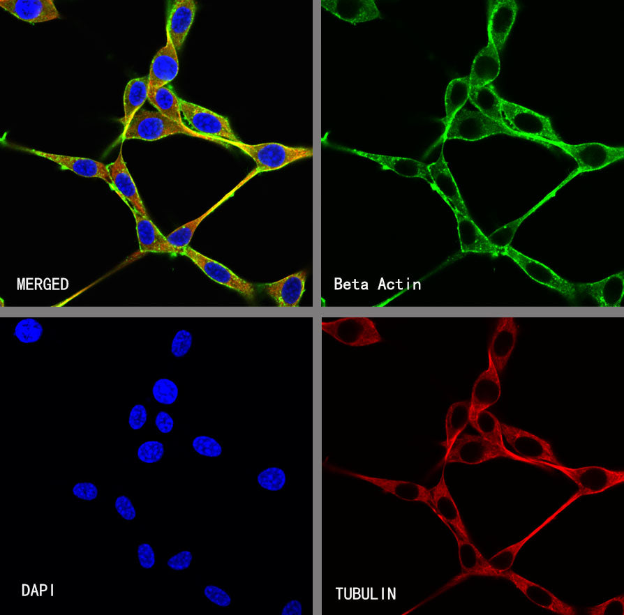 Beta Actin Recombinant Mouse mAb (S-5033)