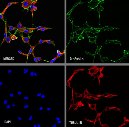 β-Actin Recombinant Rabbit mAb (S-5701)