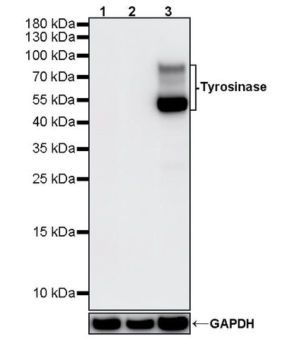 Tyrosinase Recombinant Rabbit mAb (S-5955)
