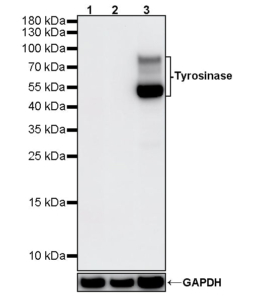 Tyrosinase Recombinant Rabbit mAb (S-5955)