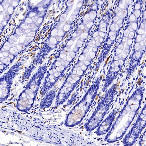 Mannose Receptor Recombinant Rabbit mAb (SDT-2206-59)