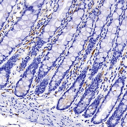 Mannose Receptor Recombinant Rabbit mAb (SDT-2206-59)