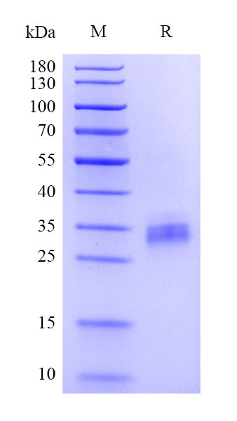 Human IGFBP-4 Protein, His Tag