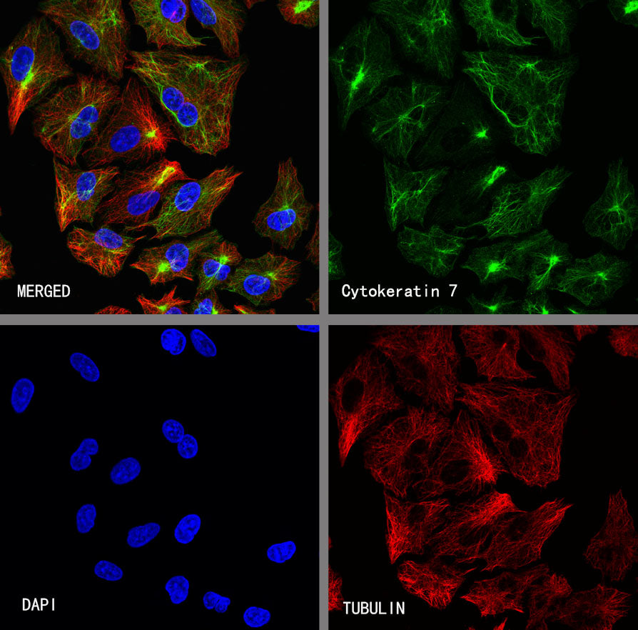 Cytokeratin 7 Recombinant Rabbit mAb (S-5954)