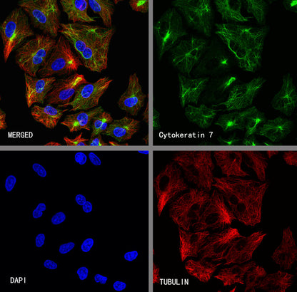 Cytokeratin 7 Recombinant Rabbit mAb (S-5954)