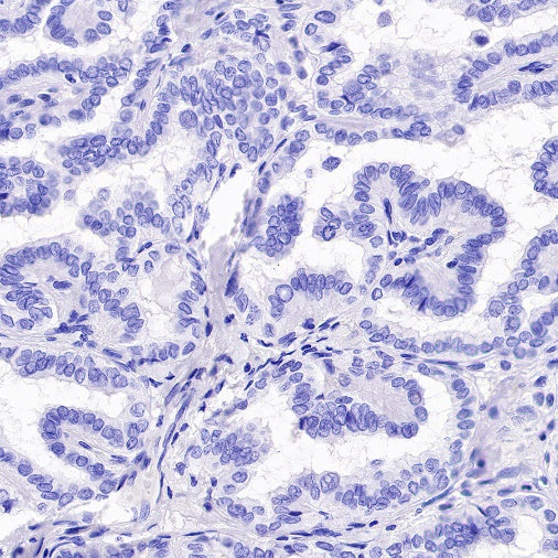 DLL3 Recombinant Rabbit mAb (S-207-179)