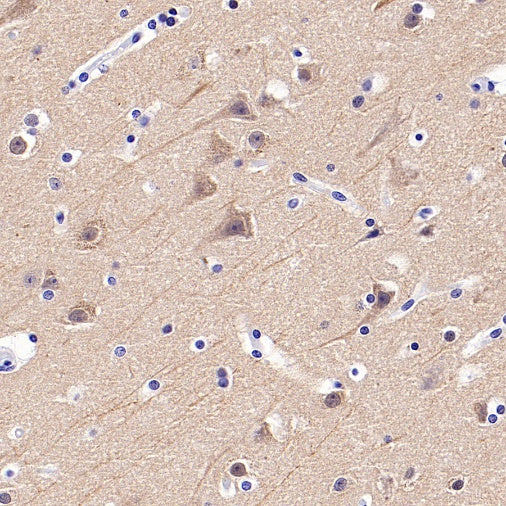 Beta II tubulin Recombinant Rabbit mAb (S-1055-2)