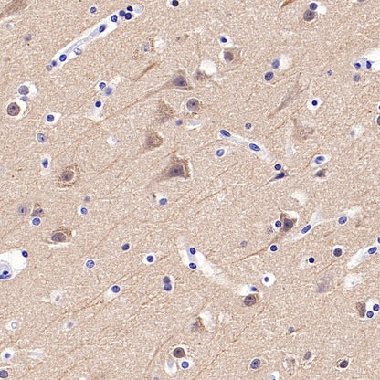 Beta II tubulin Recombinant Rabbit mAb (S-1055-2)