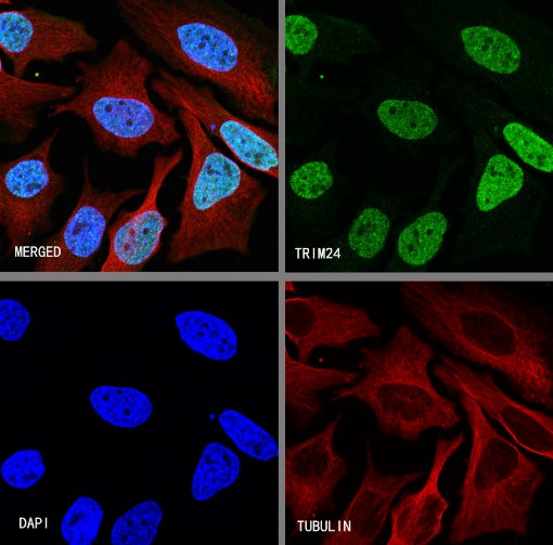TRIM24 Recombinant Rabbit mAb (S-1029-77)