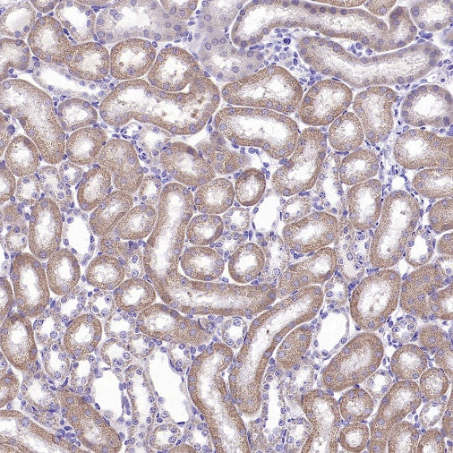 GRP75 Rabbit Polyclonal Antibody