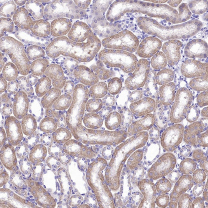 GRP75 Rabbit Polyclonal Antibody