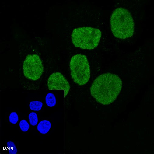 EWSR1/EWS Recombinant Rat mAb (S-R201)