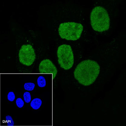 EWSR1/EWS Recombinant Rat mAb (S-R201)