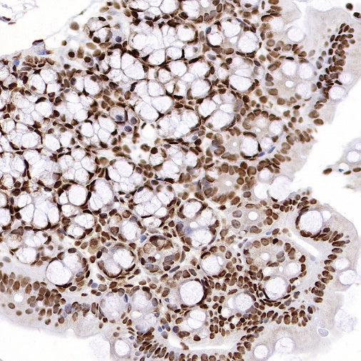 hnRNPK Recombinant Rabbit mAb (S-1645-45)