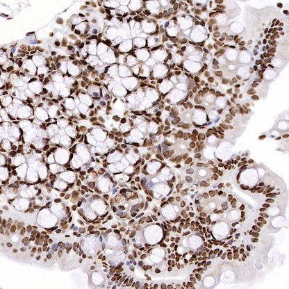 hnRNPK Recombinant Rabbit mAb (S-1645-45)