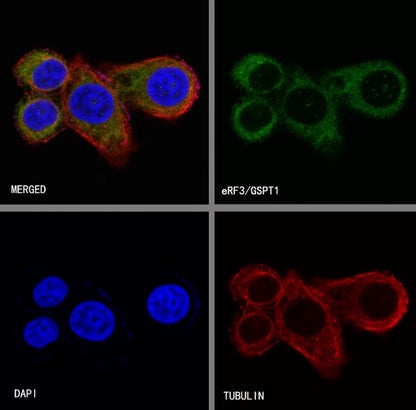 eRF3/GSPT1 Recombinant Rabbit mAb (S-R325)