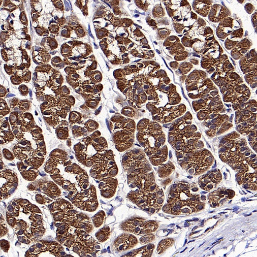 Acetyl-CoA Carboxylase Recombinant Rabbit mAb (S-2220-96)