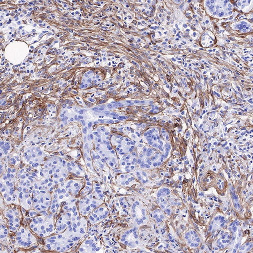 PDGFRA+PDGFRB Recombinant Rabbit mAb (S-393-11)