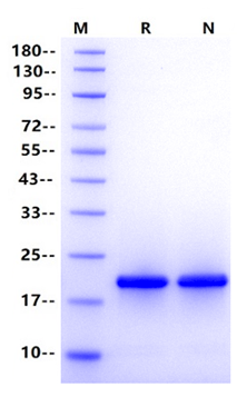 KMT5A His Tag Protein, Human