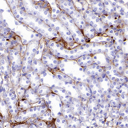 C3 Recombinant Rabbit mAb (S-5146)