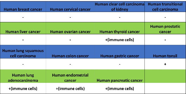 TCF-4 Recombinant Rabbit mAb,PBS Only (SDT-2549-4)
