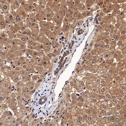 BHMT Recombinant Rabbit mAb (S-R286)
